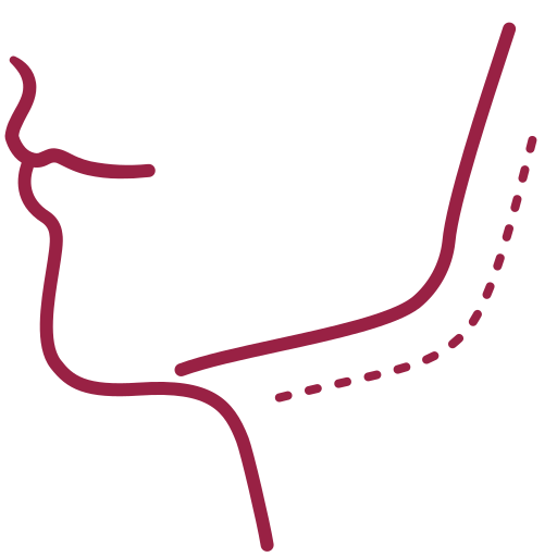 Rigenerazione ossea dei mascellari – Chirurgia preprotesica